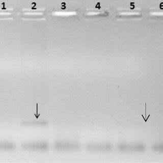 Agarose Gel Stained With Ethidium Bromide And Subjected To