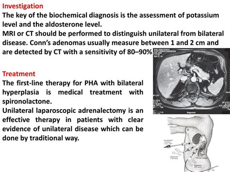 The Adrenal Glands Professor Nashwan Q Mahgoob Ppt Video Online Download