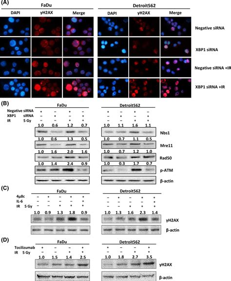 The Ire Xbp Pathway Regulates Radioresistance In Oropharyngeal