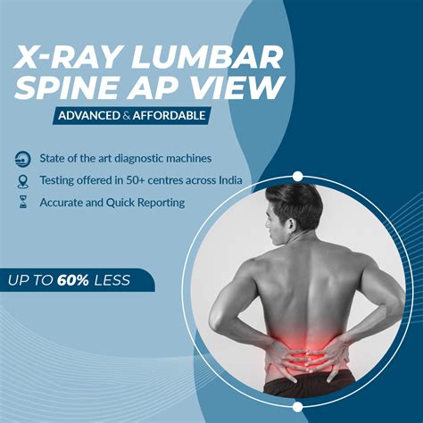 X-ray Lumbar Spine AP view - Aarthi Scans and Labs