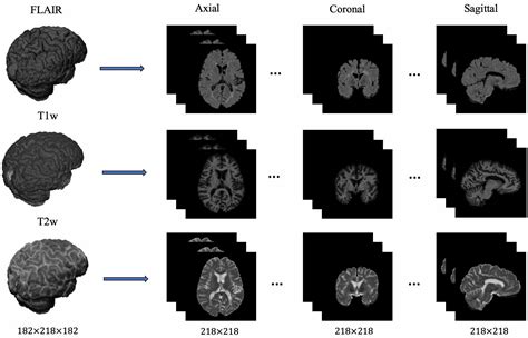 Multi Branch Convolutional Neural Network For Multiple Sclerosis Lesion Segmentation Deepai