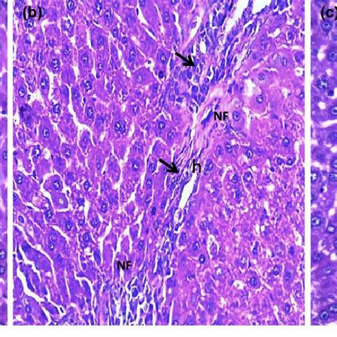 Representative Photomicrographs Of Liver Sections Stained With H E