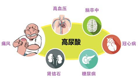 健康管理师身体出现这三种症状，说明尿酸高得可怕！