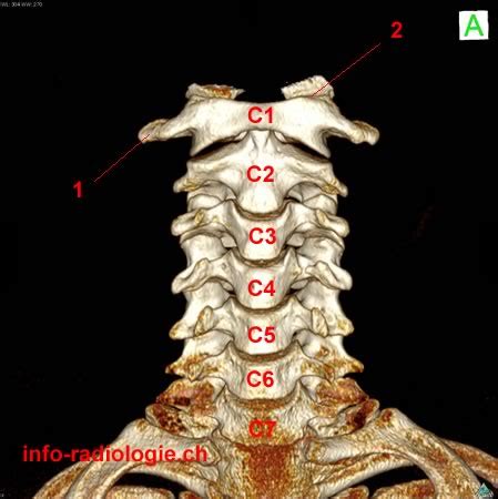 Les vertèbres cervicales