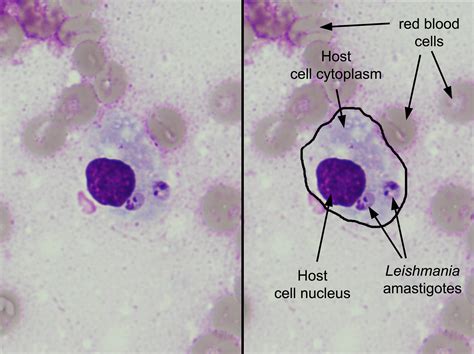 Creepy Dreadful Wonderful Parasites