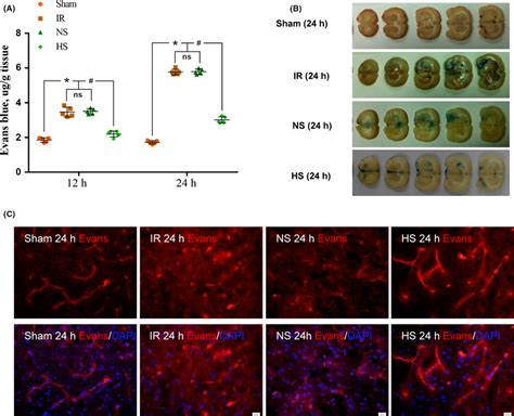 Permeability Of The Brainblood Barrier Reflected By Evans Blue