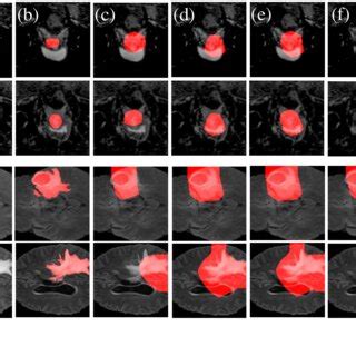Example results of our Framework on BraTS and DECATHLON: (a) Source ...