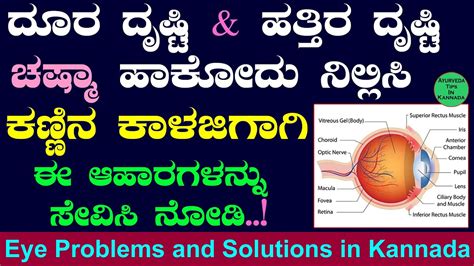 Eye Problems And Solutions In Kannada Common Eye Disorders And