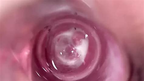 Vagina Von Innen Free Porn Video XHamster