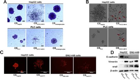 Culture Supernatant From Icc Cells Induces Emt In Hcc Cells A Colony Download Scientific