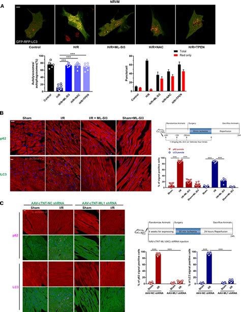 Blunting TRPML1 Significantly Restores The Blocked Autophagic Flux In