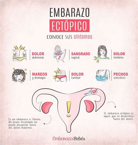 Embarazo Ectópico ¿qué Es【 Sintomas Y Causas