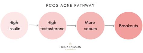 PCOS Acne: Natural Solutions (2022) | Fiona Lawson