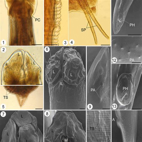 Photomicrographs Showing The Adult Stages Of Habronema Microstoma