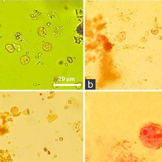 Endolimax Nana Cyst