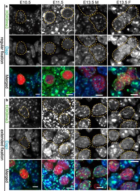 H K Me Signal Enrichment Persists On Pericentric Heterochromatin