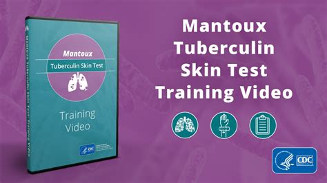 Mantoux Tuberculin Skin Test Toolkit Video Tuberculosis Tb Cdc