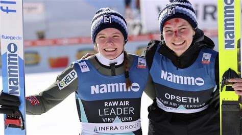 Silje Opseth With A Bloody Nose To The World Record In Ski Flying