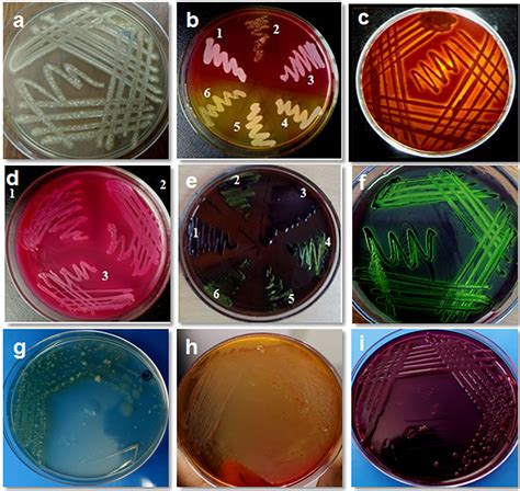 Klebsiella Pneumoniae Emb