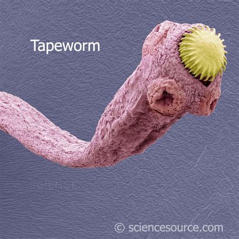 Science Source On Instagram “tapeworm Sem Color Enhanced Scanning Electron Micrograph Sem Of