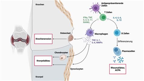 Rheumatoide Arthritis DocCheck