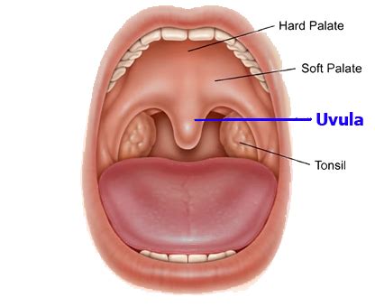 Circumstitions Uvulectomy