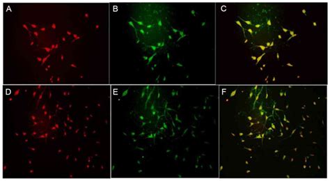 Effects Of GinsenosideRg1 On The Proliferation And Gliallike Directed