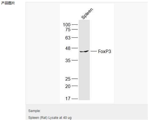 叉头蛋白p3抗体 北京拜尔迪生物技术有限公司