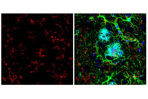 TMEM119 E4B9S Mouse MAb Cell Signaling Technology