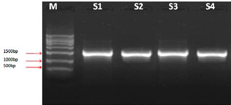 Pcr Amplification Of Bacterial Genomic Dna With S Primers S S