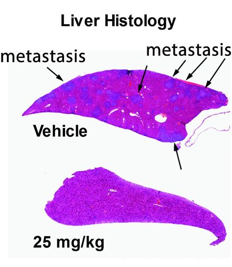 NIH, Northwestern scientists develop potential new approach to stop ...