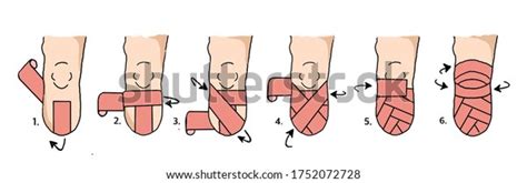 Stump Bandaging Royalty Free Images Stock Photos And Pictures Shutterstock