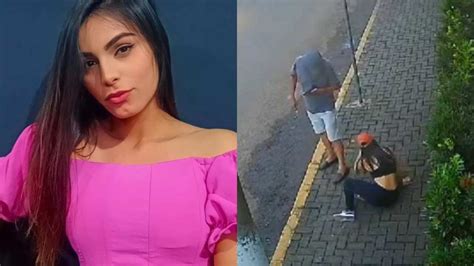 Rosto queimando jovem de 23 anos é atacada ácido e fica em estado