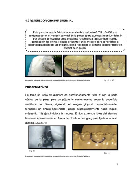 Manual De Ortodoncia Por Andrea Berrios Pdf