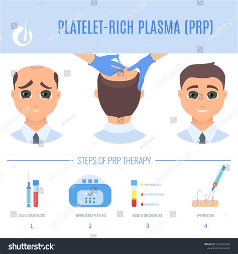 Platelet Rich Plasma Injection Procedure Prp Stock Vector Royalty Free