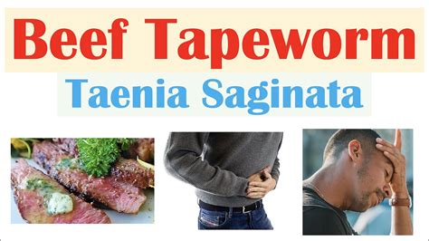 Beef Tapeworm (Taeniasis) | How It Infects, Signs & Symptoms, Diagnosis ...