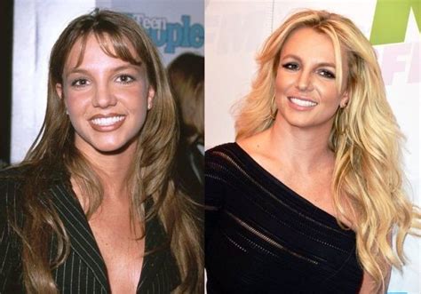 Britney Spears before and after plastic surgery 08 | Celebrity plastic ...