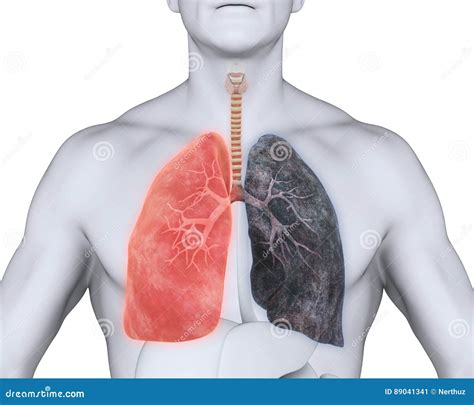 Healthy Lung And Smokers Lung Stock Photo Cartoondealer