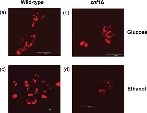 Confocal Fluorescent Micrographs Showing The Mitochondrial Oxa Rfp