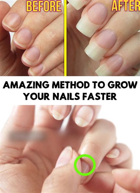 How To Grow Your Nails Faster In Just 1 Week