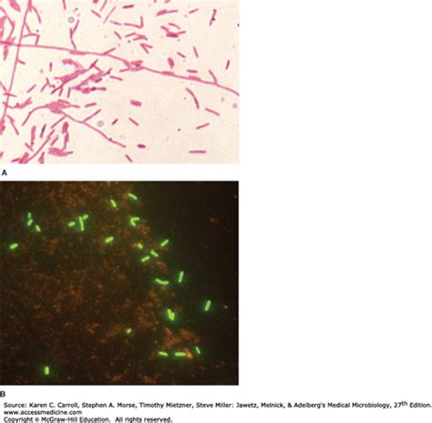 Legionella Bartonella And Unusual Bacterial Pathogens Basicmedical Key