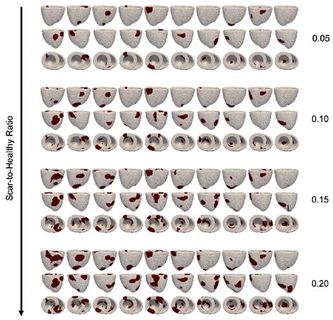 Scar tissue generated for each simulation. The nonconducting and ...