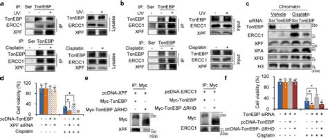 Tonicity Responsive Enhancer Binding Protein Promotes Stemness Of Liver