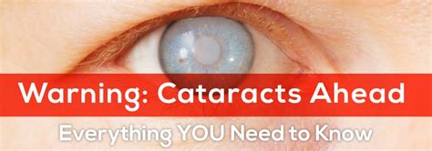 Warning Cataracts Ahead Anderson Eye Care