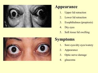 Exophthalmos, thyroid eye disease. | PPT