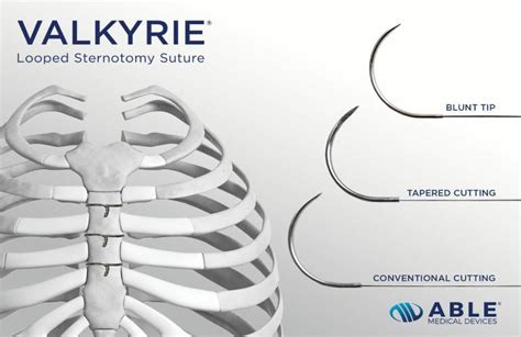 Able Medical launches Valkyrie looped sternotomy sutures