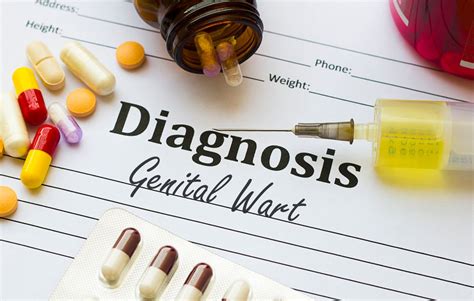 Genital Warts Treatment