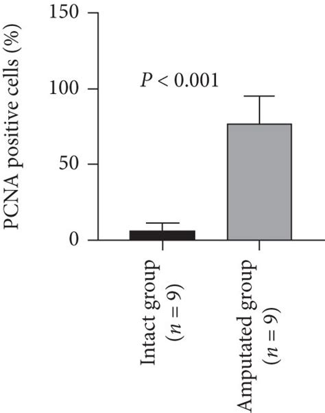 Immunohistochemical Analysis On The Pcna Positive Proliferating Cells Download Scientific