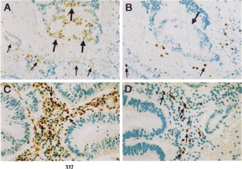 Adenomatous colonic polyps | Semantic Scholar