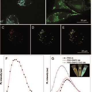 Fluorescence images of HeLa cells stained with A 1 μM TPA MPI for 15